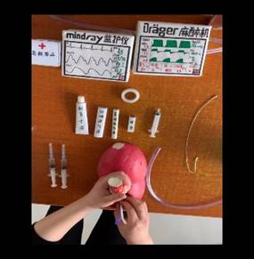 气管插管术模拟操作—16级麻醉10班-孙小松-1652011008_Moment